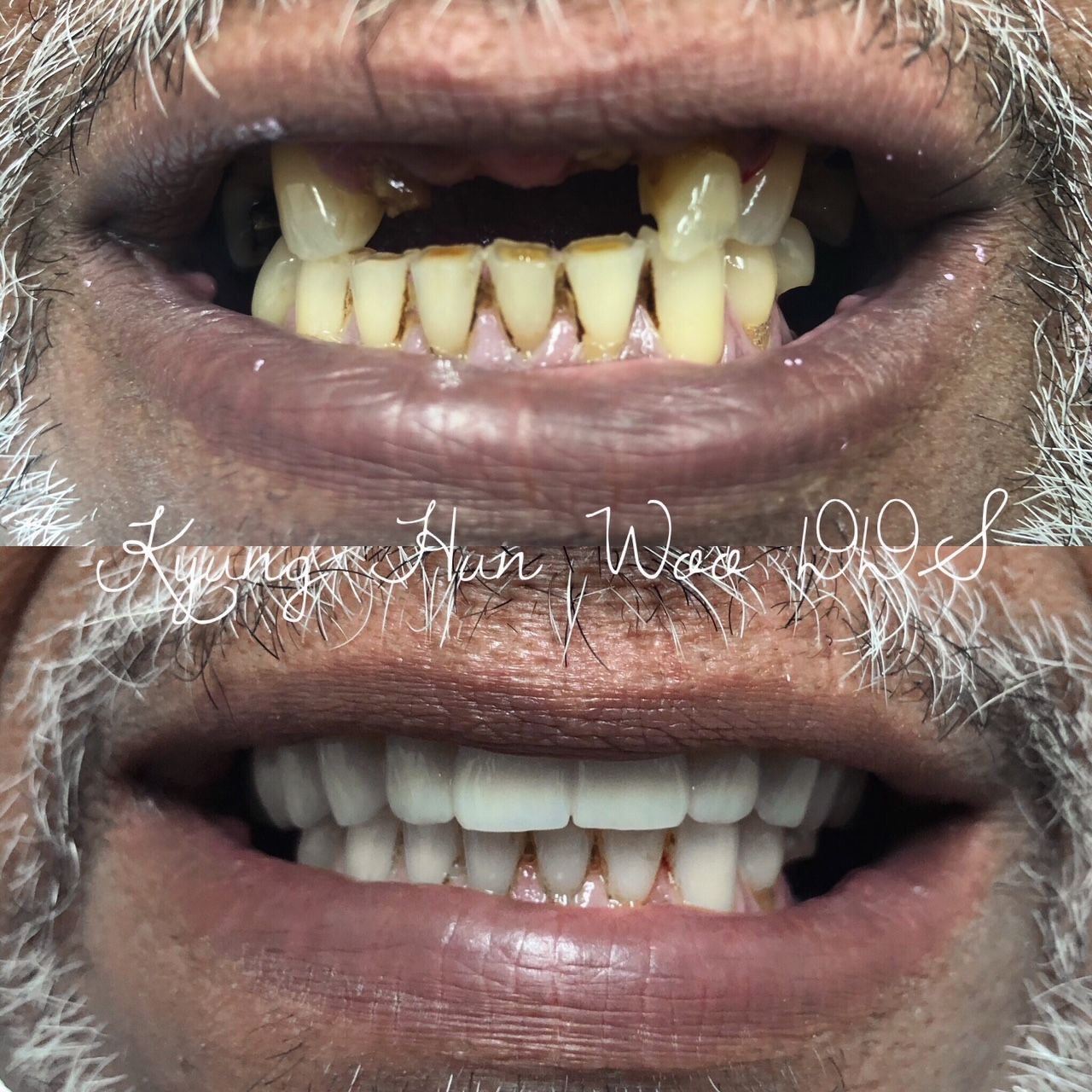 smile gallery photo 5