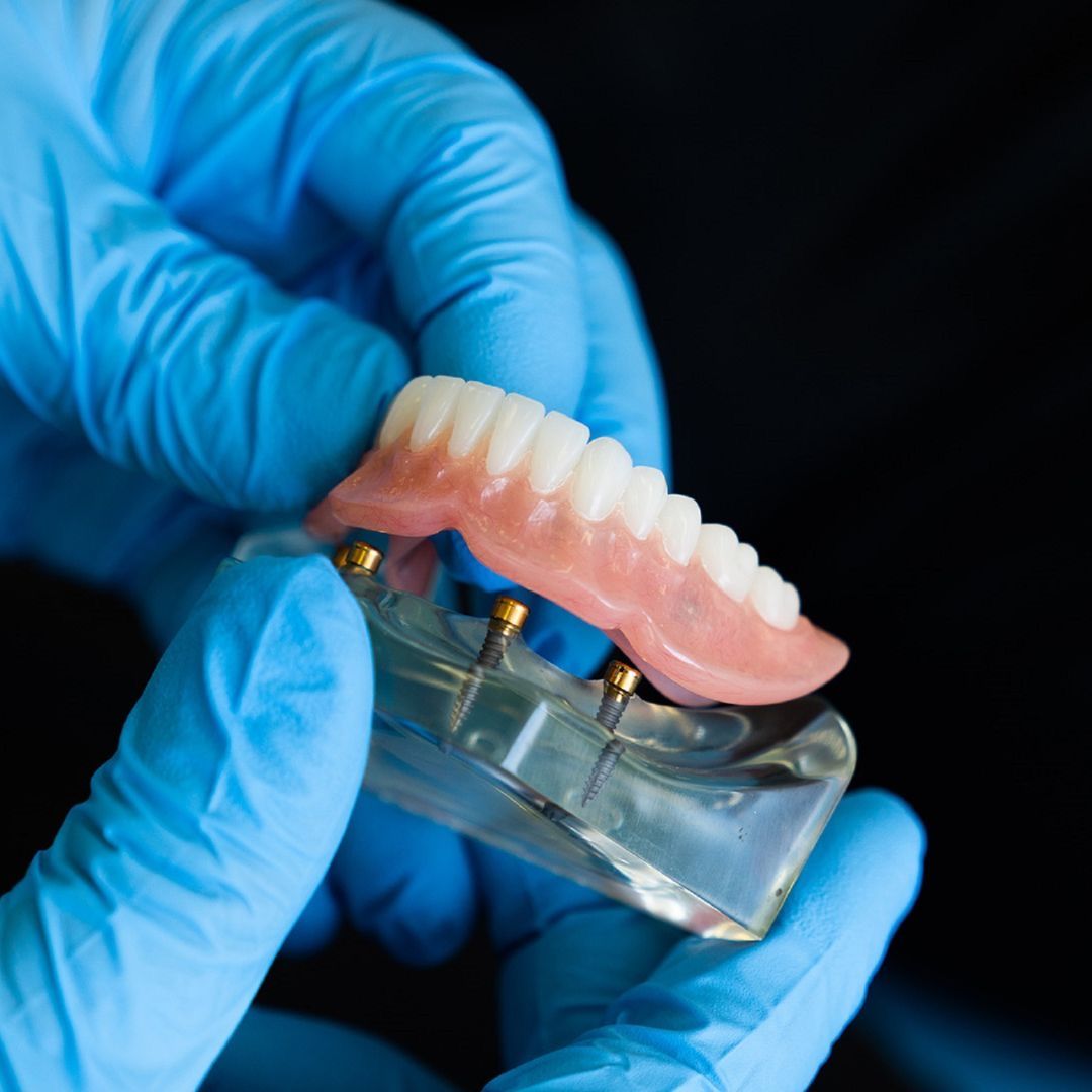 Woo Dental Implant-Supported Dentures care