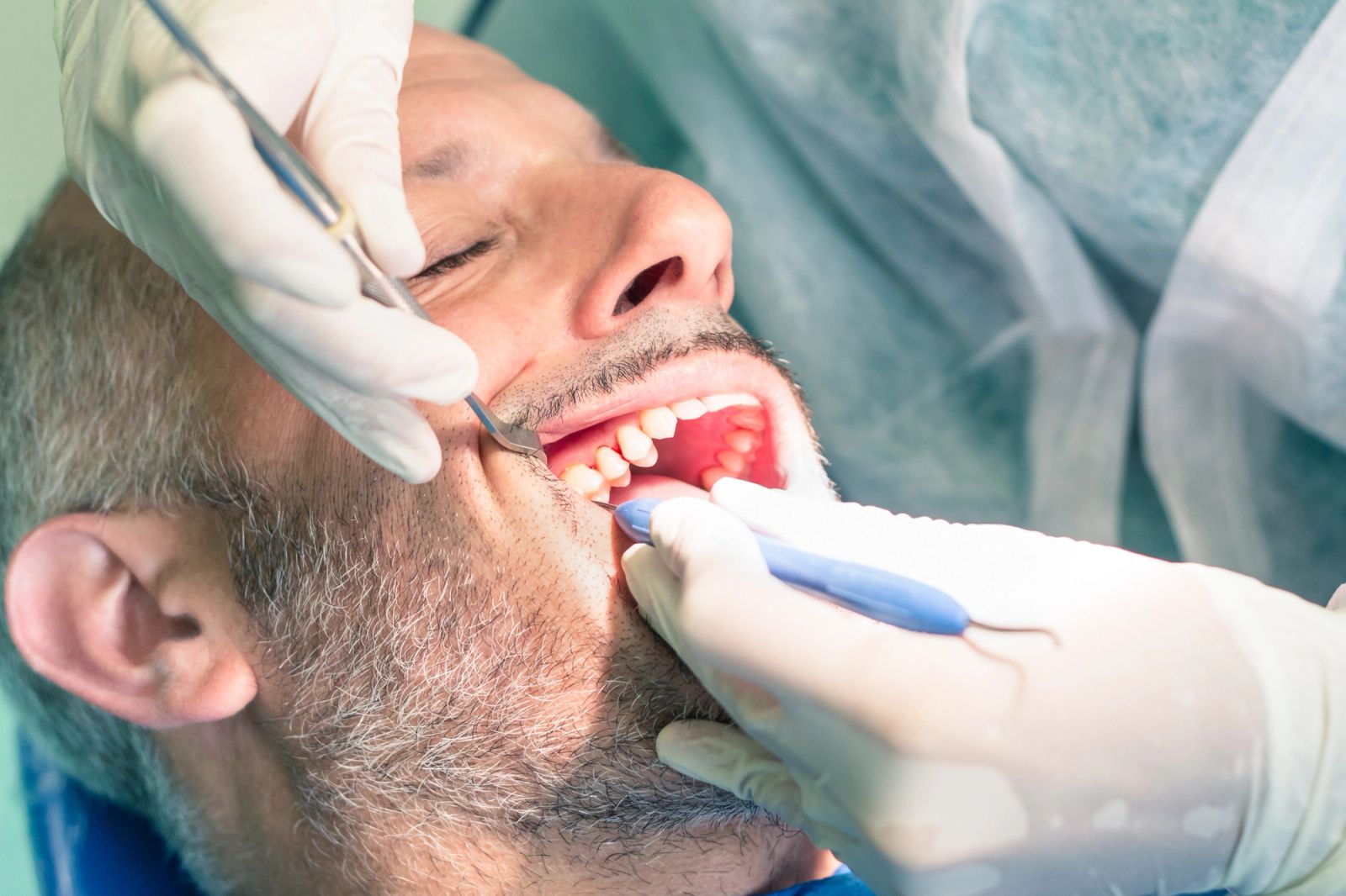 Dentist examining a patient's mouth.