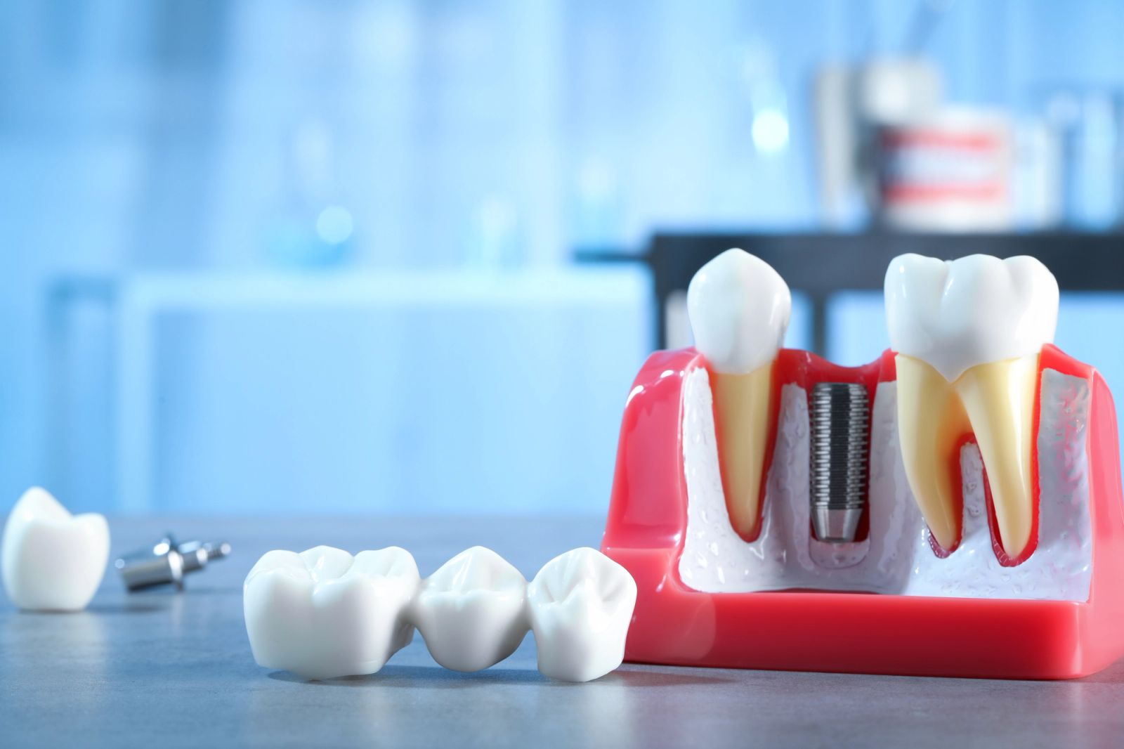 a model of a dental implant is sitting on a table .