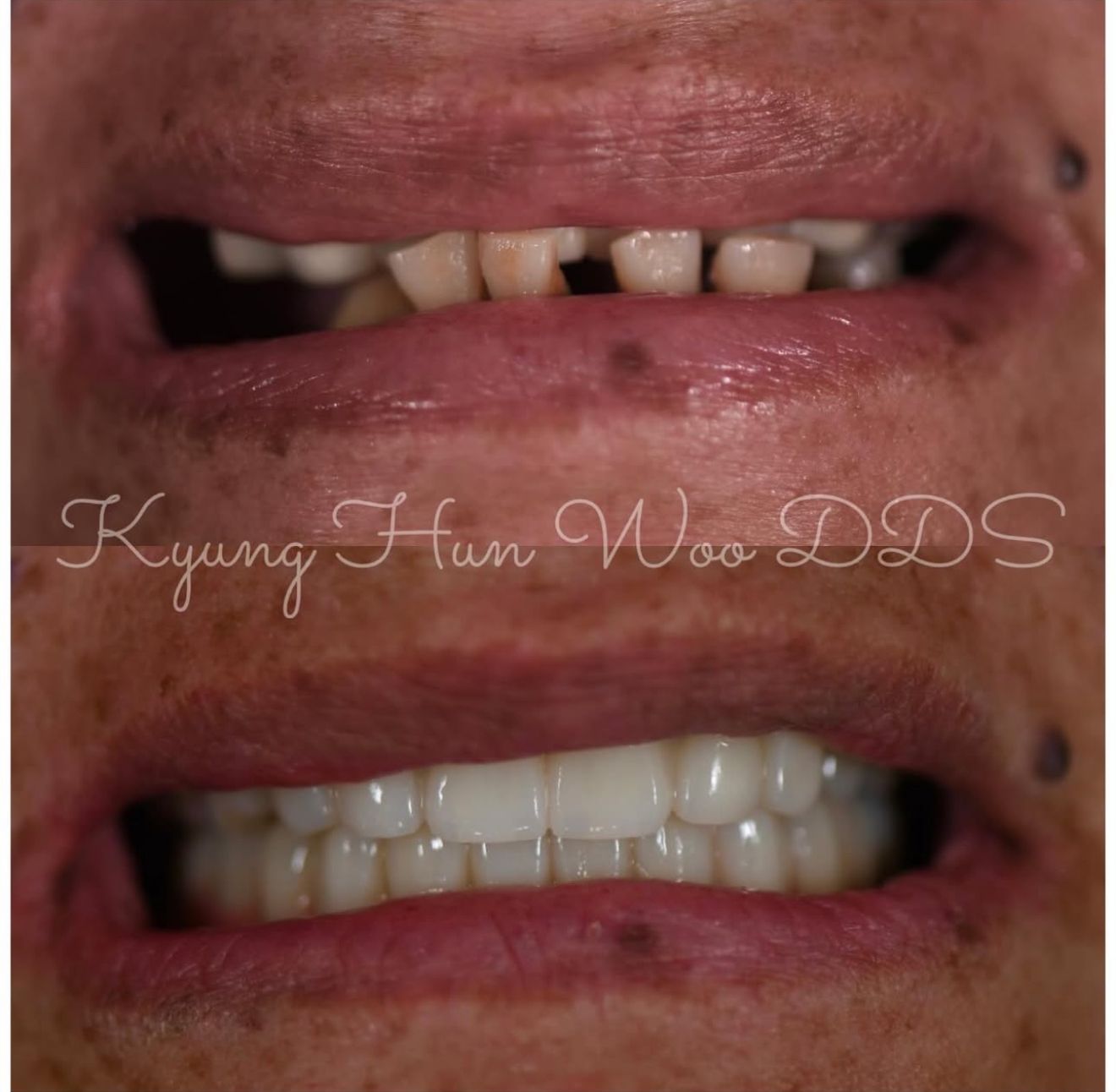 smile gallery photo 7