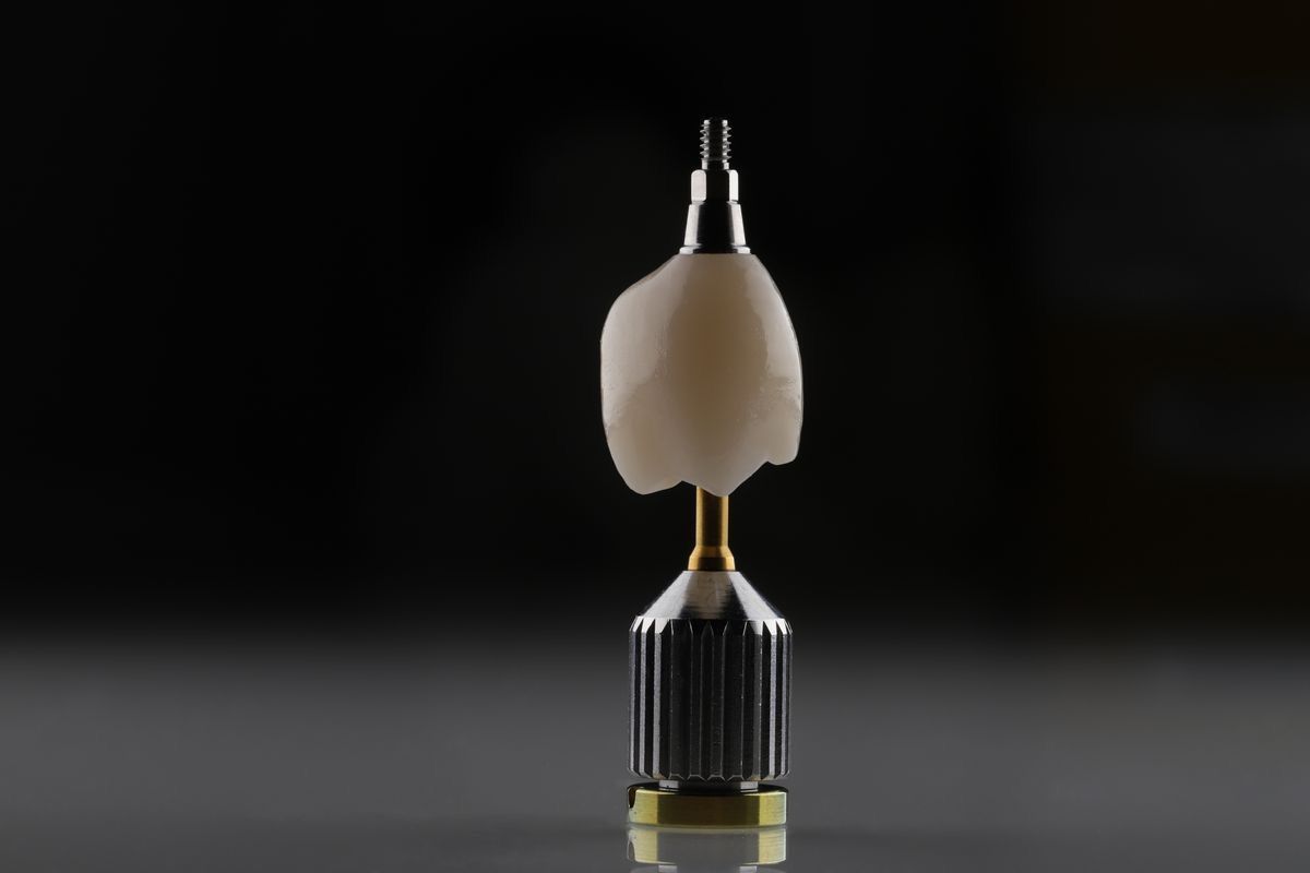 Woo Dental Dental Implants care