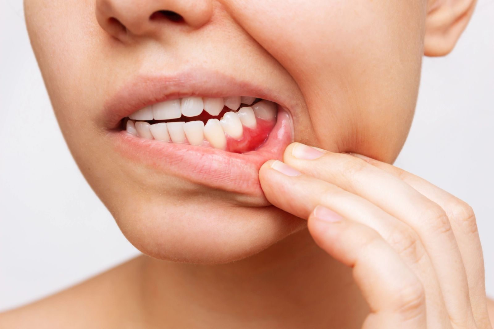 Featured image for Gum Disease Treatment at Woo Dental: Protecting Your Smile from the Ground Up