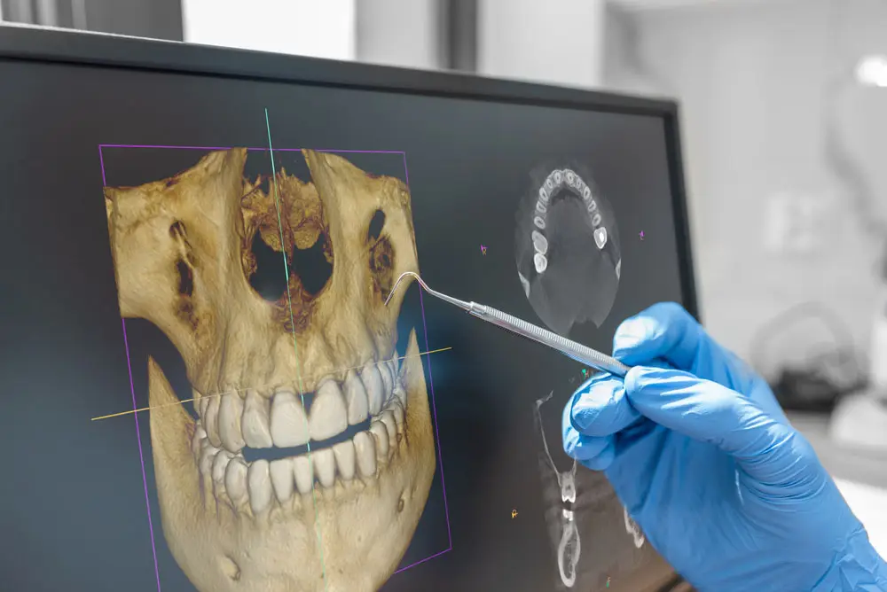 Featured image for Digital Dental X-Rays: How Modern Imaging Helps Protect Your Smile Earlier